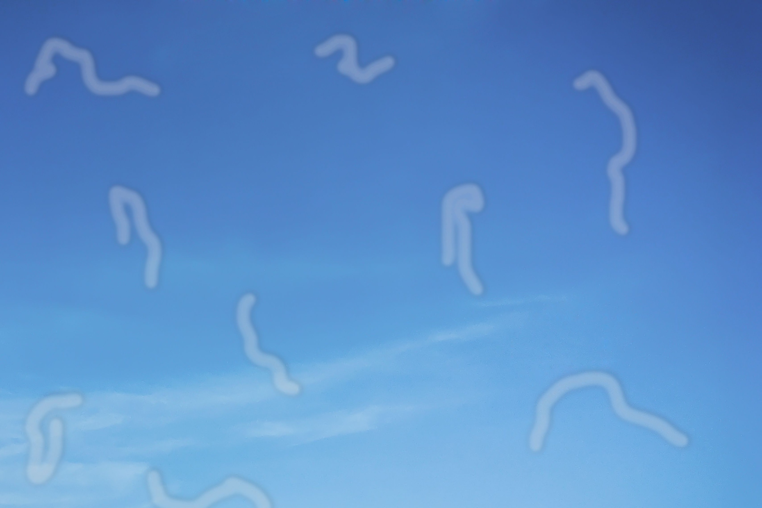 Unveiling the Mystery of Eye Floaters: What You Need to Know